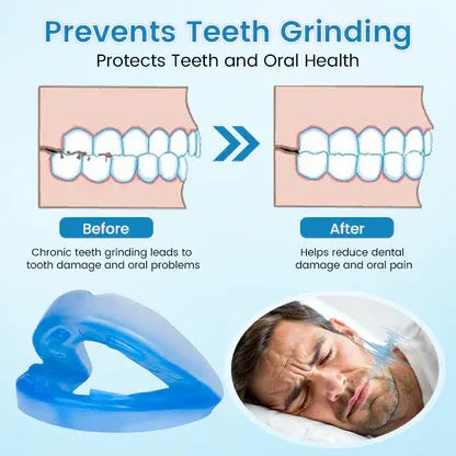 Anti Snoring Mouth Guard