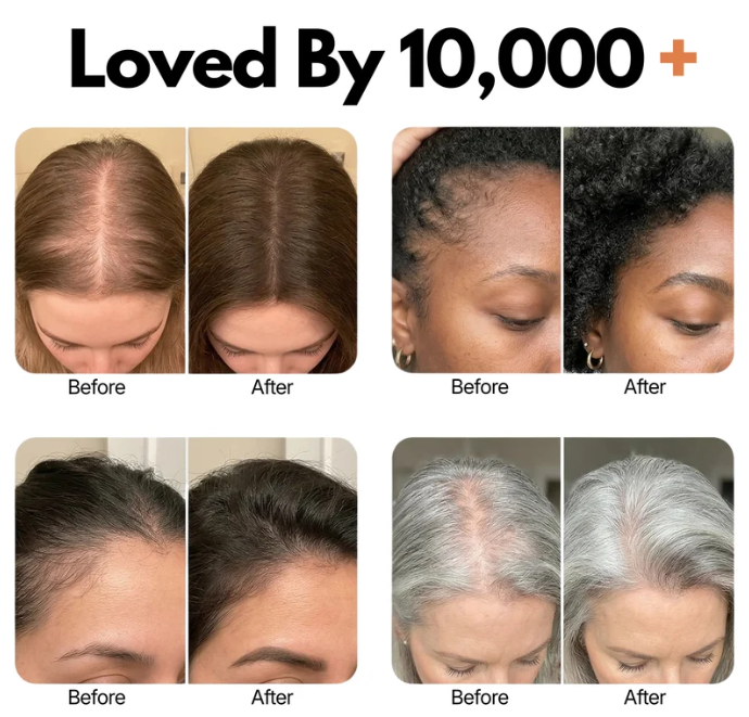 PDRN + Caffeine Hair Serum