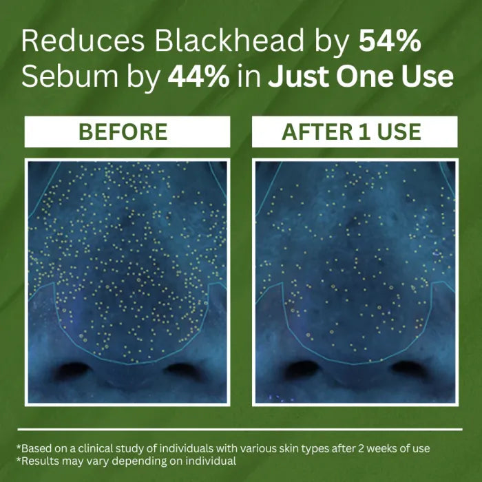 Basil Sparkling Bubble Mask