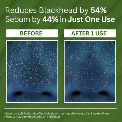 Basil Sparkling Bubble Mask